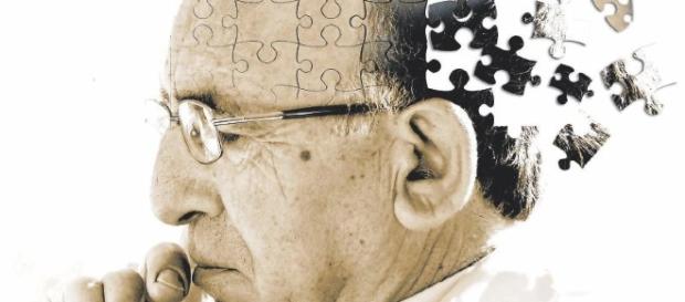 O Mal de Alzheimer é uma das doenças mais misteriosas O Mal de Alzheimer é uma das doenças mais misteriosas