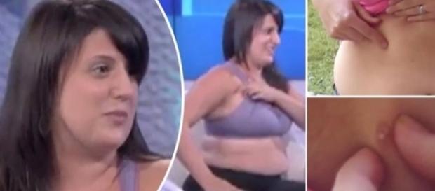 Por ter sete mamilos a mais do que o normal, Leah diz que sente especial e única Por ter sete mamilos a mais do que o normal, Leah diz que sente especial e única
