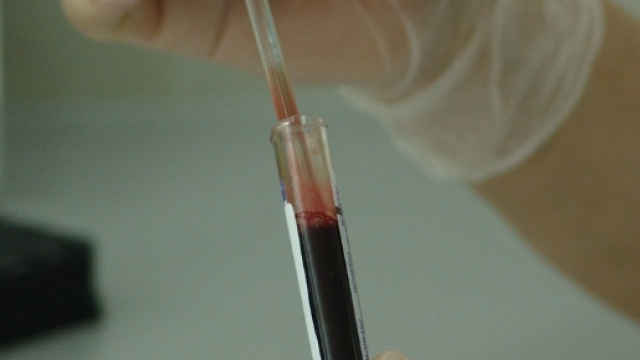 Le mucche producono anticorpi contro l'Hiv