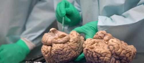 Study: CTE Affects Football Players At All Levels - Image - Associated Press | YouTube