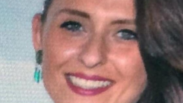 Katie Widdowson, morta a 24 anni per una rara infezione che dal polso le ha 'mangiato' i tessuti. Foto: Facebook.