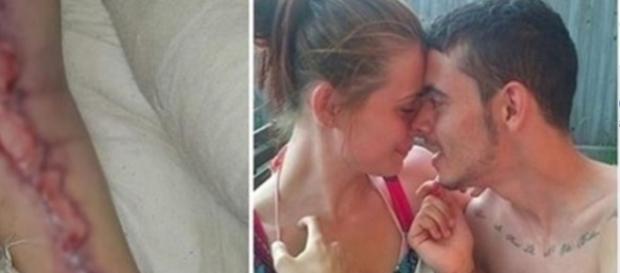 Mulher morre ao contrair bactéria em ato sexual Mulher morre ao contrair bactéria em ato sexual