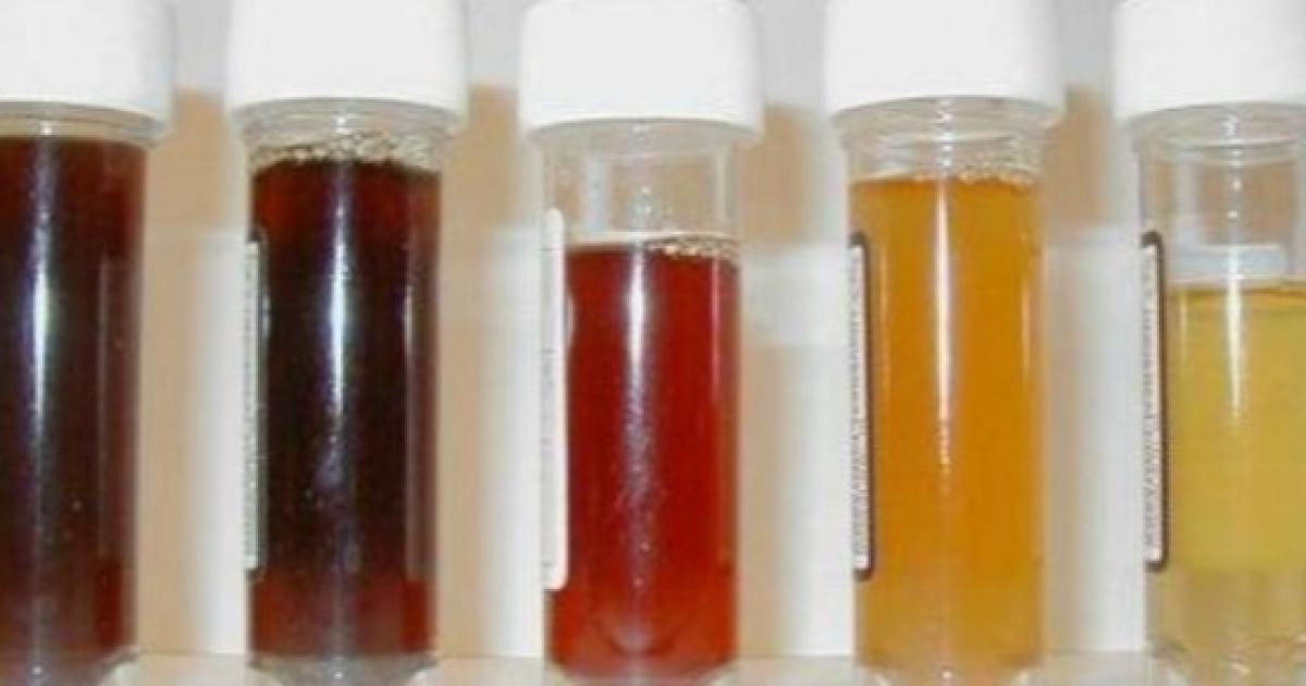 Sei in salute? Impara a interpretare la tua urina Sei in salute? Impara a interpretare la tua urina