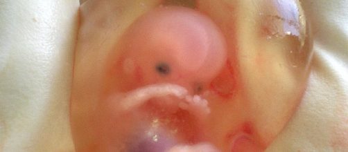Human fetus at 10 weeks (drsuparna wikimedia)