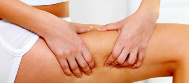 Cellulite, come combatterla con rimedi semplici Cellulite, come combatterla con rimedi semplici