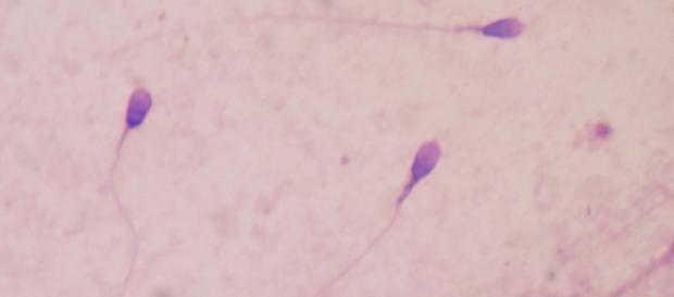 Sperm counts among men in Western nations are reportedly decreasing. - Bobjgalindo/Wikimedia Commons Sperm counts among men in Western nations are reportedly decreasing. - Bobjgalindo/Wikimedia Commons