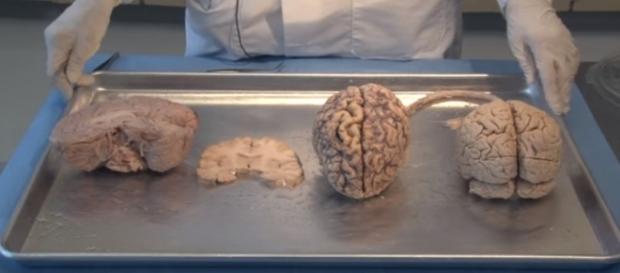 Aging controlled by the hypothalamus - e-channel/YouTube Aging controlled by the hypothalamus - e-channel/YouTube