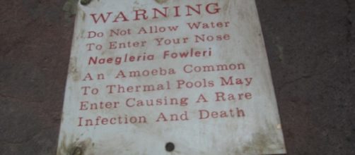A signage warning pool-goers of the possible presence of brain-eating amoeba (Image Credit: justslm/Flickr)