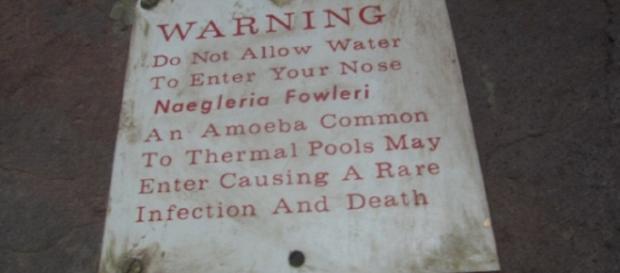 A signage warning pool-goers of the possible presence of brain-eating amoeba (Image Credit: justslm/Flickr) A signage warning pool-goers of the possible presence of brain-eating amoeba (Image Credit: justslm/Flickr)