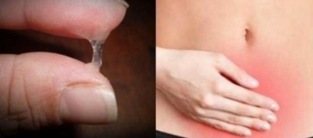 Corrimento vaginal pode esconder doenças - Google Corrimento vaginal pode esconder doenças - Google