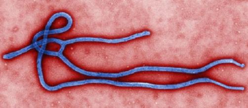 Ebola Virus credits:wikipedia https://en.wikipedia.org/wiki/File:Ebola_virus_virion.jpg