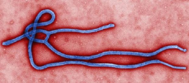 Ebola Virus credits:wikipedia https://en.wikipedia.org/wiki/File:Ebola_virus_virion.jpg Ebola Virus credits:wikipedia https://en.wikipedia.org/wiki/File:Ebola_virus_virion.jpg