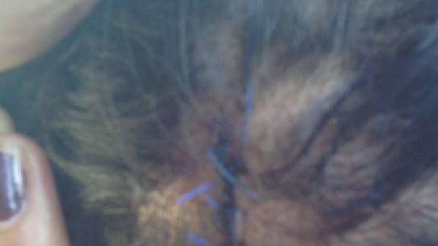 Punti sulla testa della bambina Rom