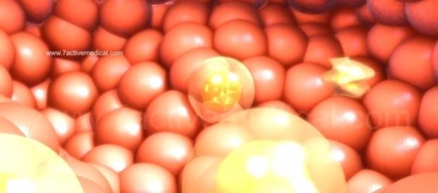 Does chemotherapy do more harm? - YouTube/7activestudio Does chemotherapy do more harm? - YouTube/7activestudio