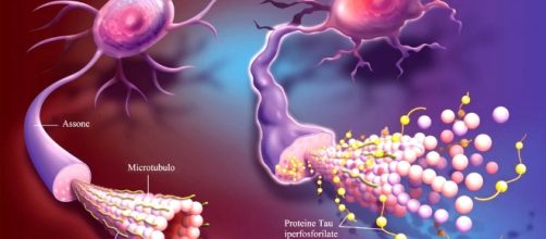 Alzheimer: scoperta la struttura della proteina Tau