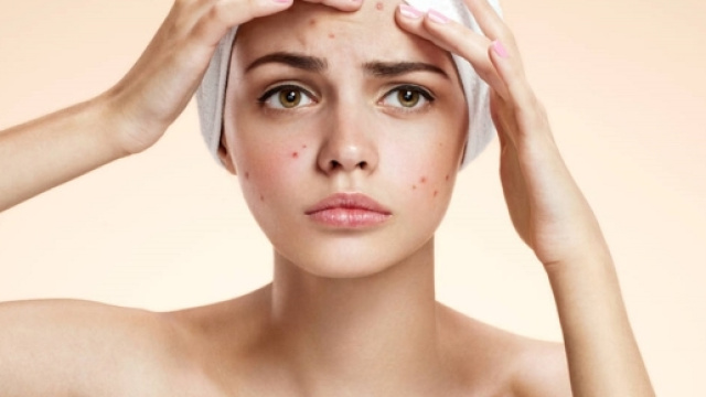 Acne e brufoli ko con 3 semplici trattamenti a base di sale - foto:inran