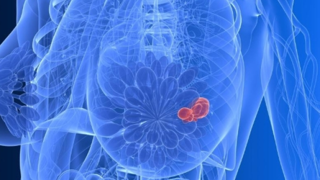 Le regole per prevenire il cancro