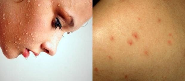 Os sintomas da AIDS incluem perda de peso, febre ou sudorese noturna, fadiga e infecções recorrentes. Os sintomas da AIDS incluem perda de peso, febre ou sudorese noturna, fadiga e infecções recorrentes.