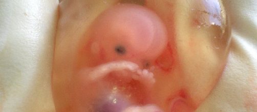 Human fetus at 10 weeks (drsuparna/wikimedia)