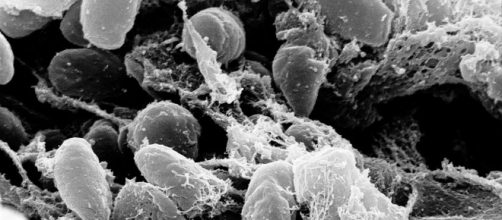 I batteri responsabili della peste in un'immagine al microscopio: c'è timore negli USA per nuovi casi e pulci infette - Credits: NIAID, NIH