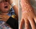 Menina britânica sofre queimaduras químicas após fazer tatuagem de henna