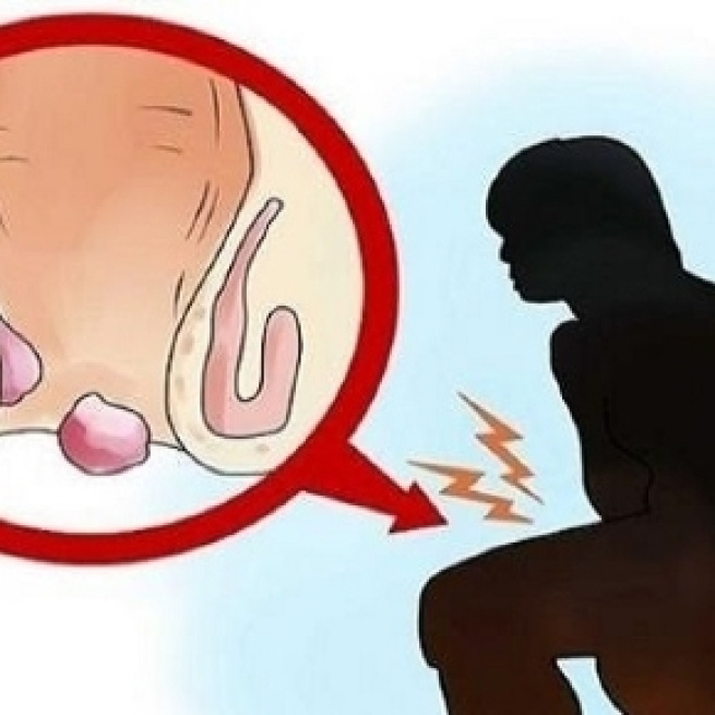 A taxa de cura do vaginismo é muito alta (Google)
