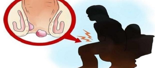 O tratamento contra o Vaginismo é eficiente e apresenta altas taxas de cura (Foto/Google) O tratamento contra o Vaginismo é eficiente e apresenta altas taxas de cura (Foto/Google)