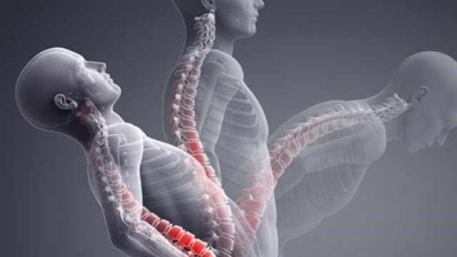 Addio dolori con la postura corretta, grazie alla fisioanalisi