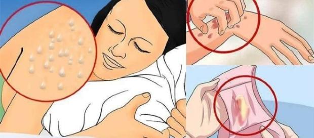 Fique atento com os sintomas e saiba como combater Fique atento com os sintomas e saiba como combater