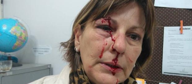Márcia Friggi foi agredida violentamente por um de seus alunos Márcia Friggi foi agredida violentamente por um de seus alunos