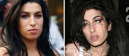 Antes e depois de famosos que abusaram das drogas