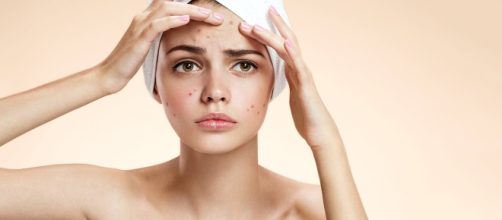 19 Best Home Remedies To Get Rid Of Blemishes On Face - stylecraze.com