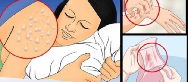 Agumas pessoas estão com HIV e nem percebem.l Agumas pessoas estão com HIV e nem percebem.l