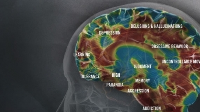 Gli effetti delle metanfetamine sul cervello (http://www.methproject.org/answers/what-does-meth-do-to-your-brain.html#Brain-Damage)