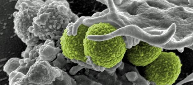 Bacteria superbugs via Pixabay Bacteria superbugs via Pixabay