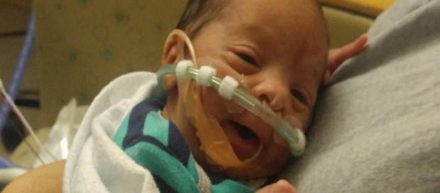 Ean, o bebê que nasceu prematuro de 29 semanas, já na maternidade Ean, o bebê que nasceu prematuro de 29 semanas, já na maternidade