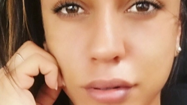 Selvaggia con le labbra rifatte