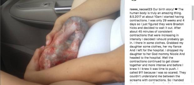 A mother gave birth to a boy still wrapped in an amniotic sac inside her car. Image Source: Realin Scurry's Instagram page A mother gave birth to a boy still wrapped in an amniotic sac inside her car. Image Source: Realin Scurry's Instagram page