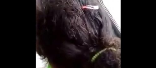 Vídeo mostra cabeça de um mulher infestada por insetos. (Foto internet)