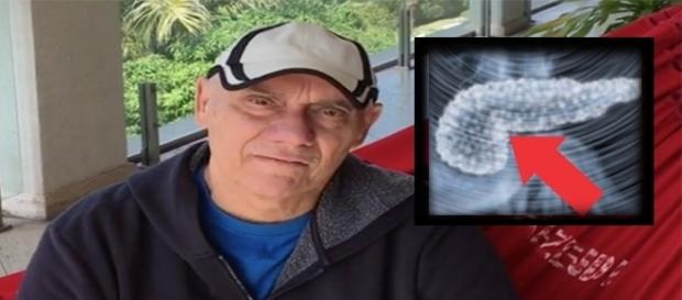 Marcelo Rezende volta a ingerir carboidratos Marcelo Rezende volta a ingerir carboidratos