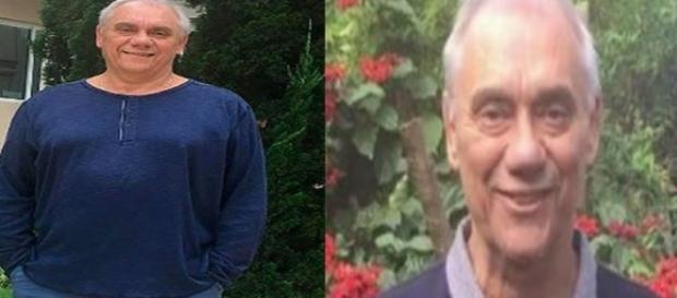 Marcelo Rezende antes e depois de ser acometido pela terrível doença Marcelo Rezende antes e depois de ser acometido pela terrível doença