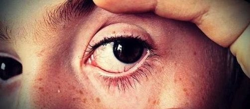 More than 22 million people have cataracts [Image: chandrabalan/YouTube screenshot]