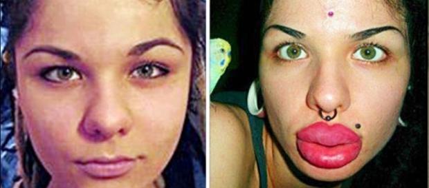 Algumas cirurgias ficaram bizarras (Foto: Reprodução) Algumas cirurgias ficaram bizarras (Foto: Reprodução)