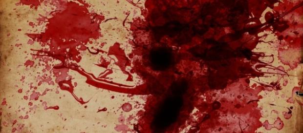 Teen bleeds from mysterioys flesh eating crustaceans- Image CCO Public domain Pixabay. Teen bleeds from mysterioys flesh eating crustaceans- Image CCO Public domain Pixabay.