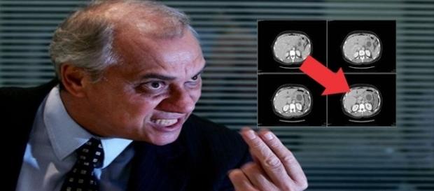 Marcelo Rezende volta a consumir carboidratos Marcelo Rezende volta a consumir carboidratos