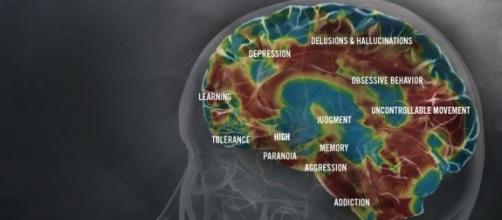 The effects of metamphetamine on the brain (http://www.methproject.org/answers/what-does-meth-do-to-your-brain.html#Brain-Damage)