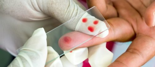 New single-dose malaria treatment could eventually help millions - theconversation.com