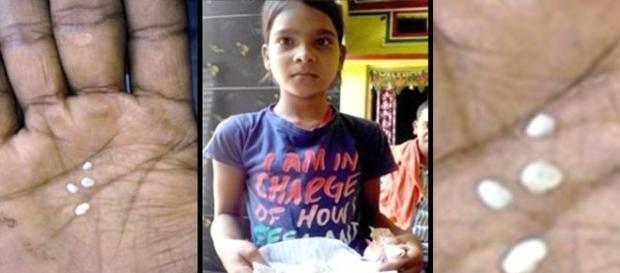 Familiares e vizinhos estão com medo da garota. Eles acreditam que ela está possuída por espírito (NDTV) Familiares e vizinhos estão com medo da garota. Eles acreditam que ela está possuída por espírito (NDTV)