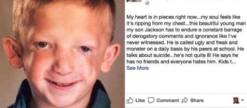 Jackson Bezzant a 8 anni oltraggiato perché soffre di una malattia che deforma i lineamenti. Il papà ha lanciato un appello su Fb.