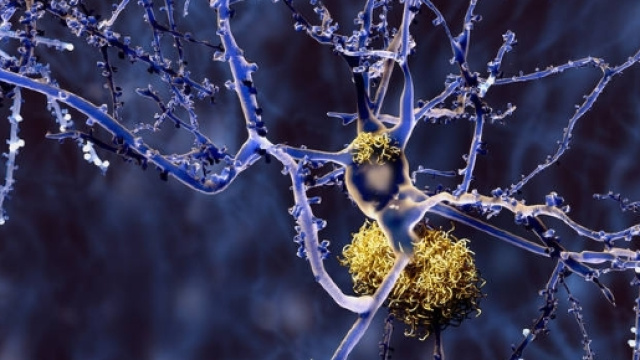 Un nuovo strumento nella diagnosi dell'Alzheimer